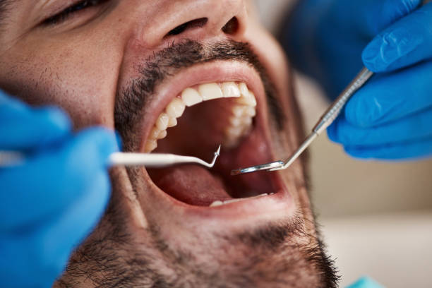 Best Emergency Dental Services for Seniors in Milton, GA